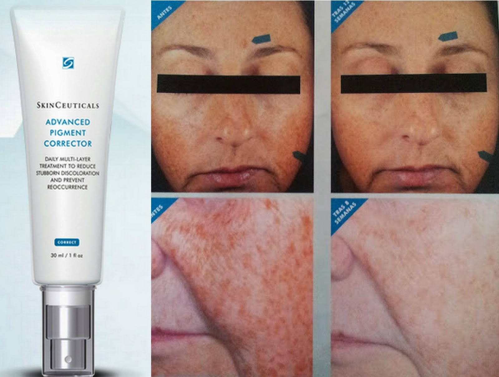 skinceuticals advanced pigment corrector review